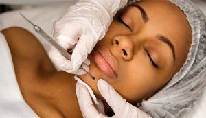 Marketing para clínicas de beleza e estética, como aumentar a procura por procedimentos AGNC Agência de Marketing ser esteticista senac sp 1 AGNC - Agência de Marketing